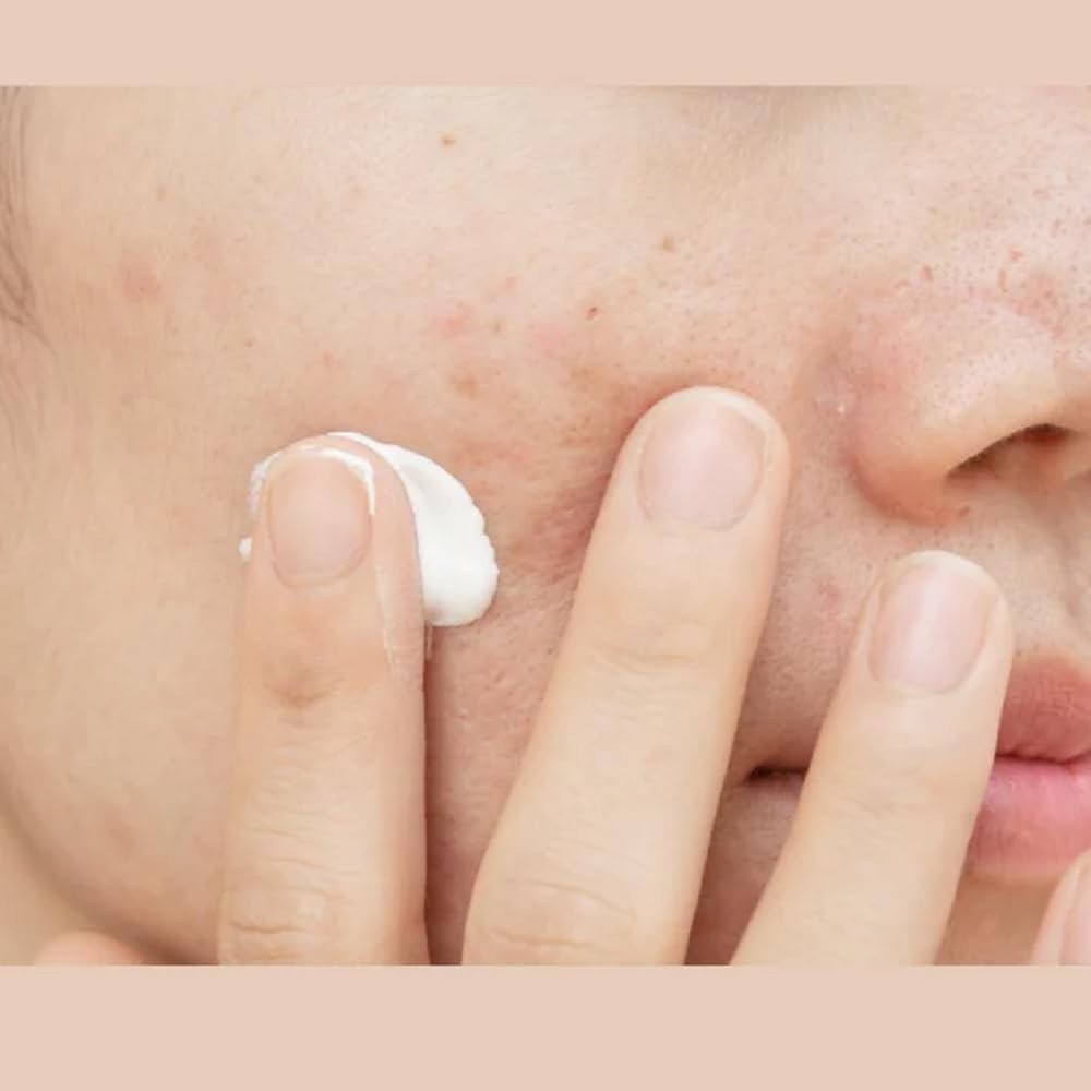 Brekout Control Daily Moisturizer 50ml