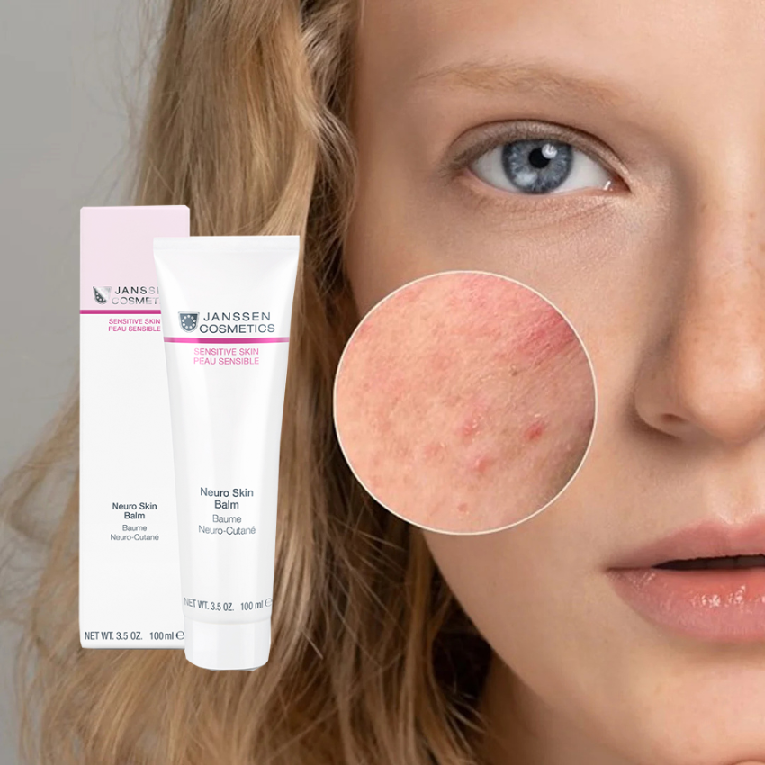 Neuro Skin Balm - Успокаивающий бальзам для раздраженной кожи 100 мл